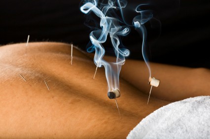 Traditional Moxibustion in downtown Toronto for breech pregnancy and pain relief