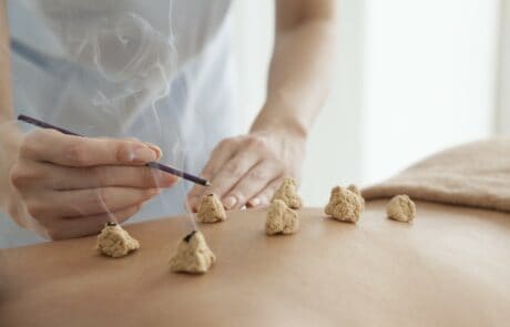 Moxibustion at Acupuncture Center Toronto great for pain pregnancy and labour