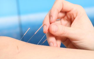 Acupuncture Center Toronto treats all health conditions with Chinese Medicine