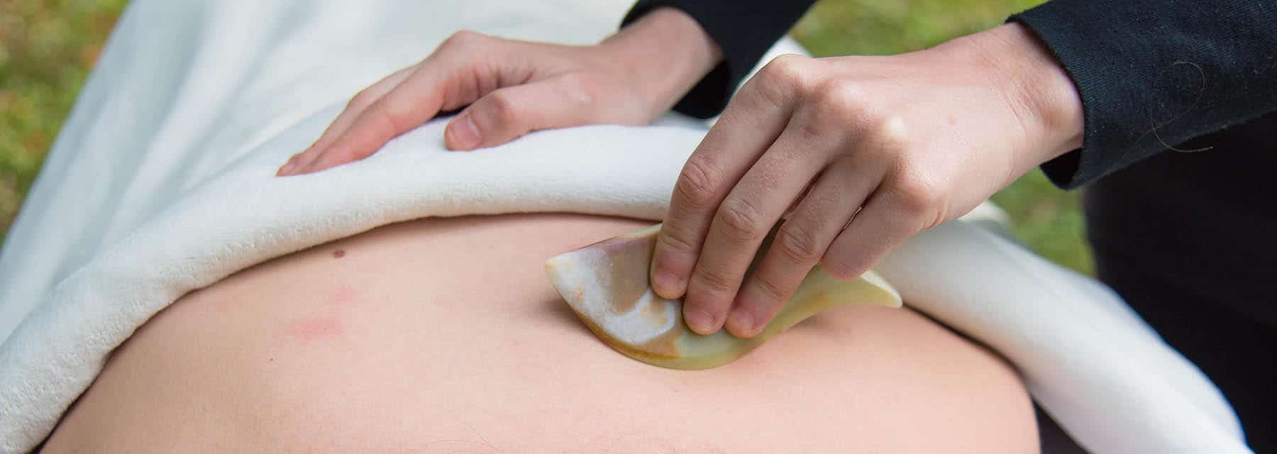 Best gua sha scraping at Acupuncture Center Toronto