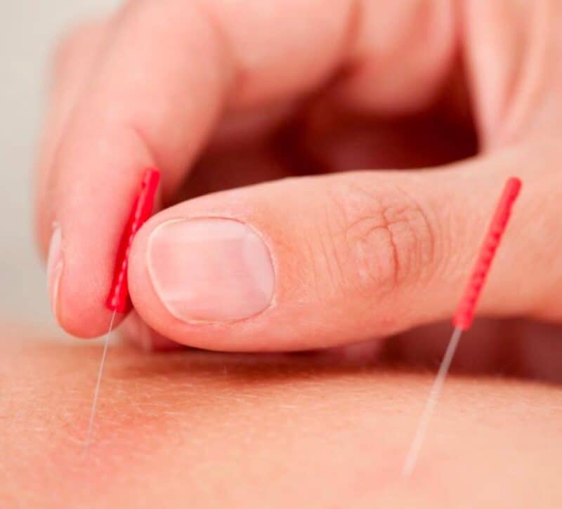 Acupuncture-Center-Toronto-best-Acupuncture-team-downtown-Yorkville-healing