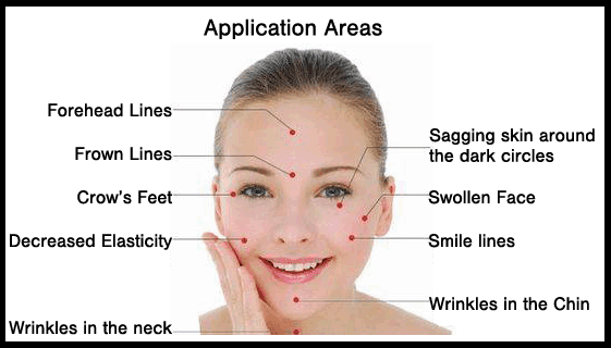 Acupuncture Center Toronto - Facial acupuncture points