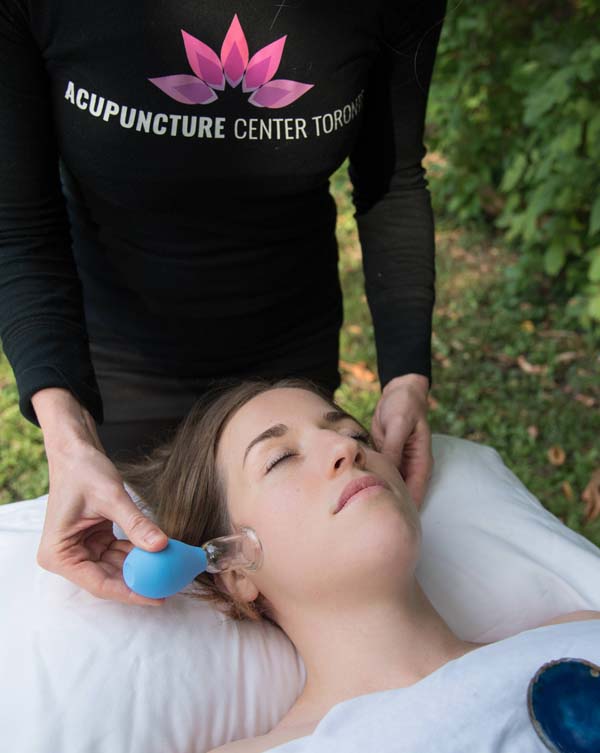 Acupuncture Center Toronto - Cosmetic acupuncture points