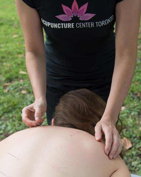 Acupuncture Center Toronto - Cosmetic acupuncture points