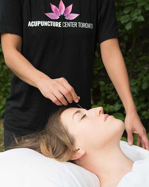 Acupuncture Center Toronto - Cosmetic acupuncture points