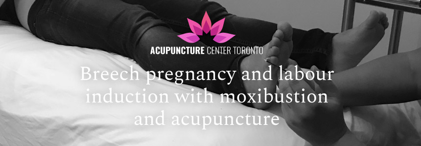 Breech pregnancy and labour induction with moxibustion and acupuncture