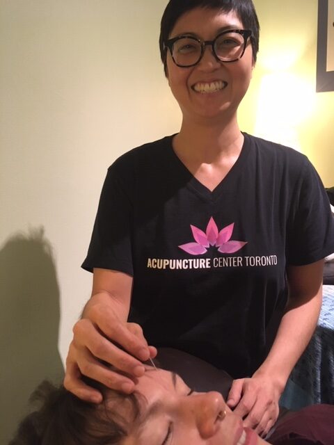 Carrie Toronto acupucturist needling Yin Tang for headach relief