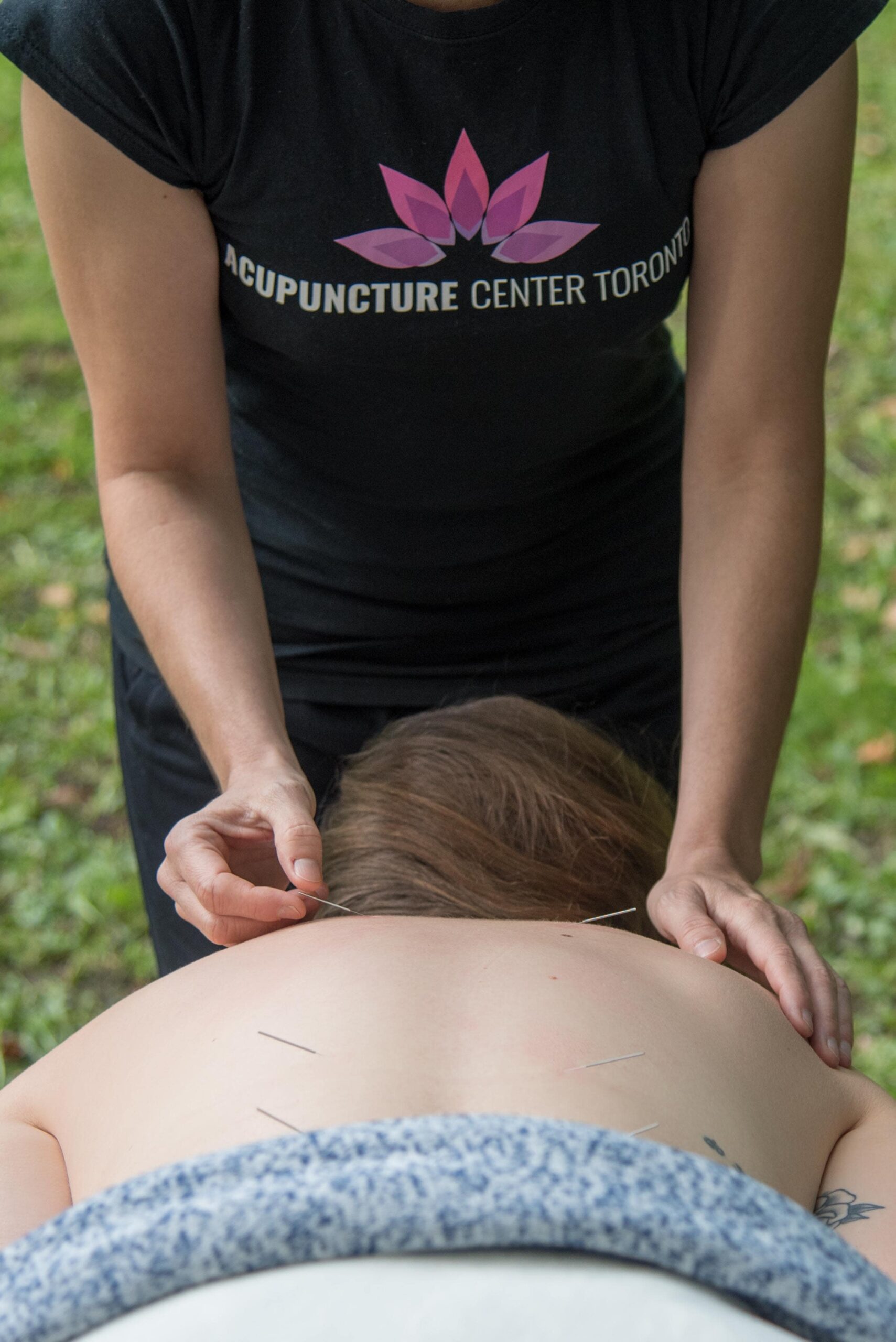 Best Acupuncture downtown yorkville Toronto