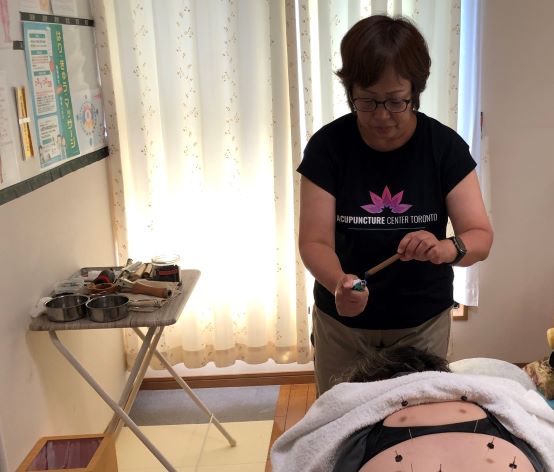 Japanese Moxibustion Master in Japan trains Registered Acupuncturist in Toronto