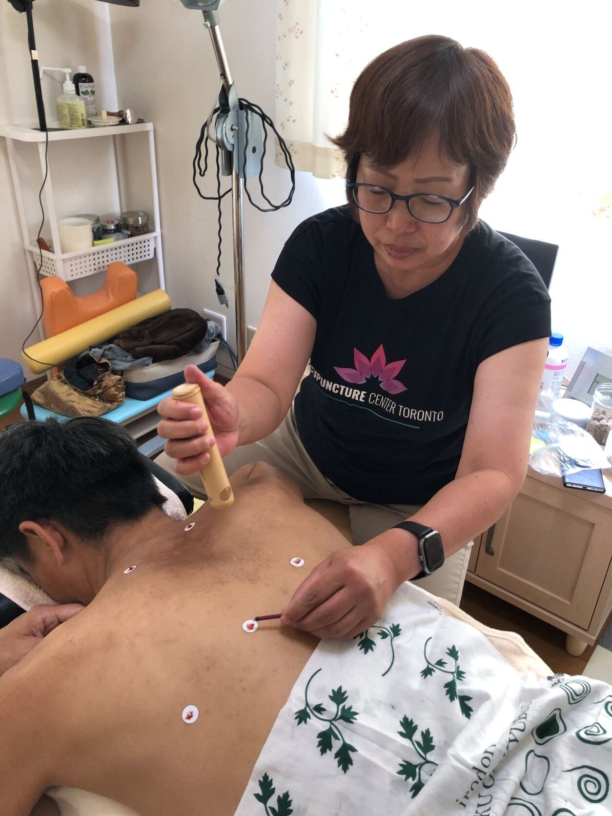 Toronto Moxibustion for pain pregnancy and labour