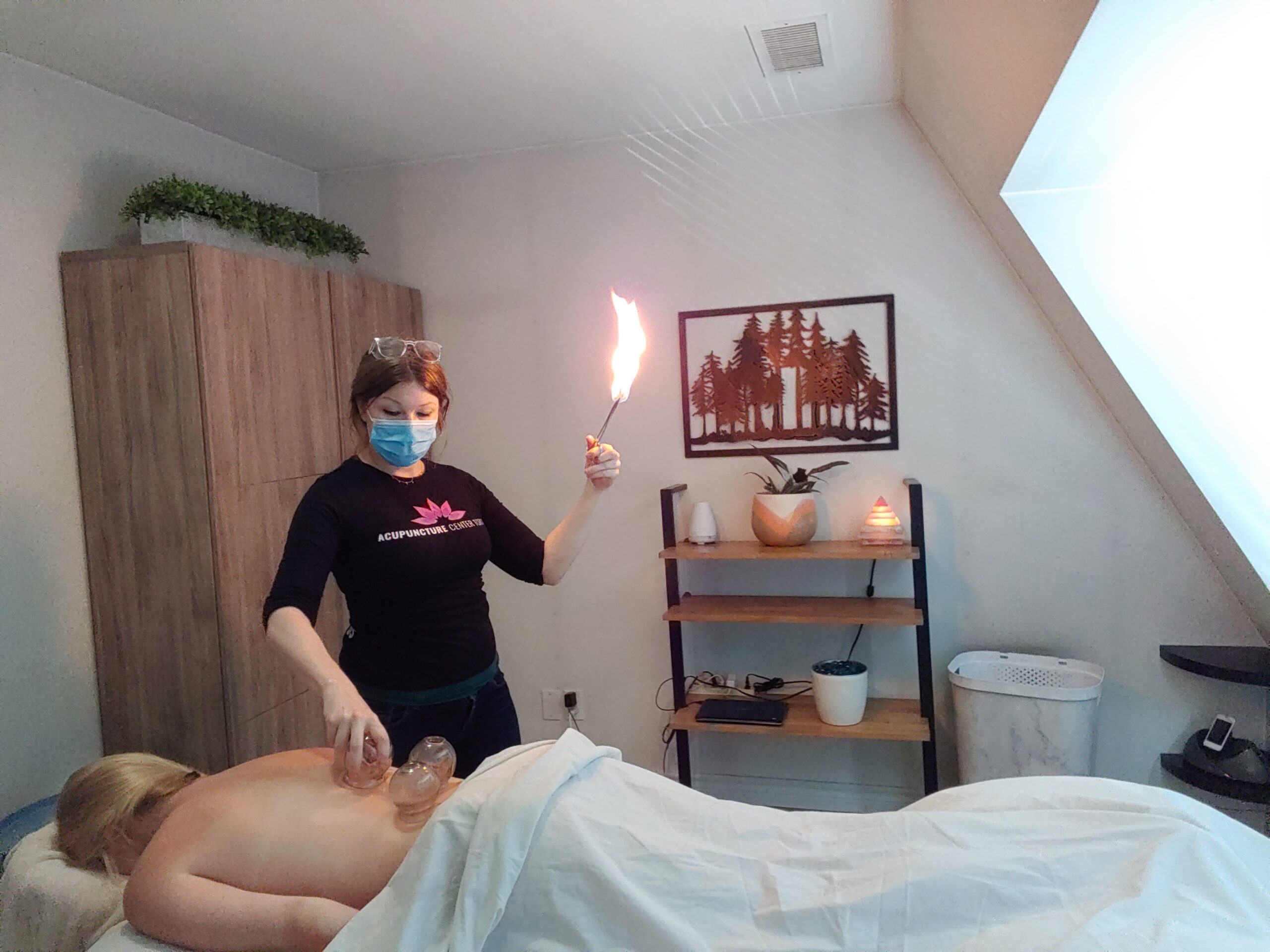 cupping therapy for sciatica in Toronto