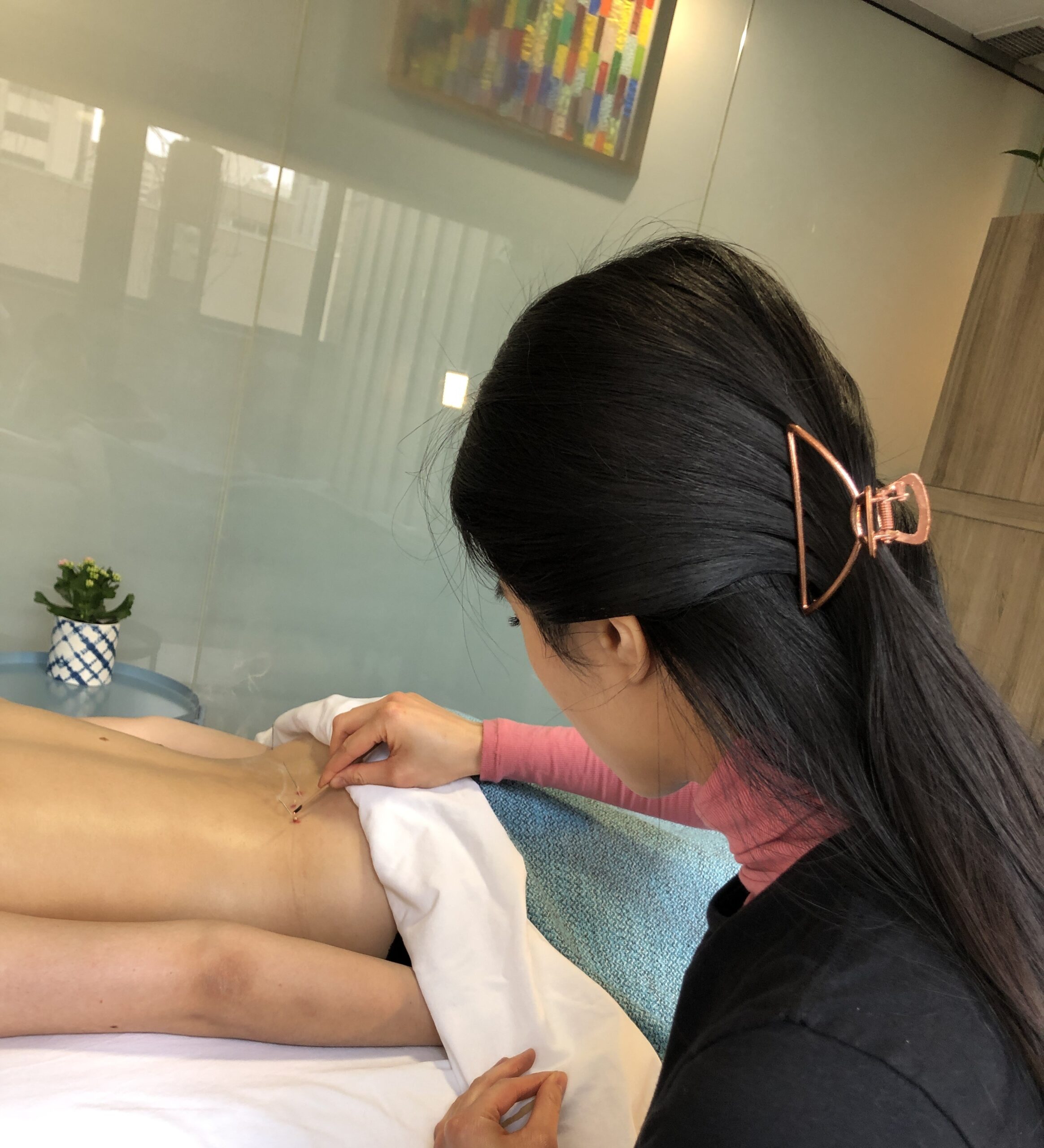 japanese moxibustion for sciatica in downtown toronto