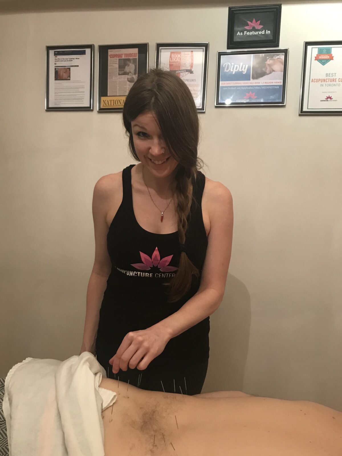 low back sciatica pain acupuncture treatment at Acupuncture Center Toronto