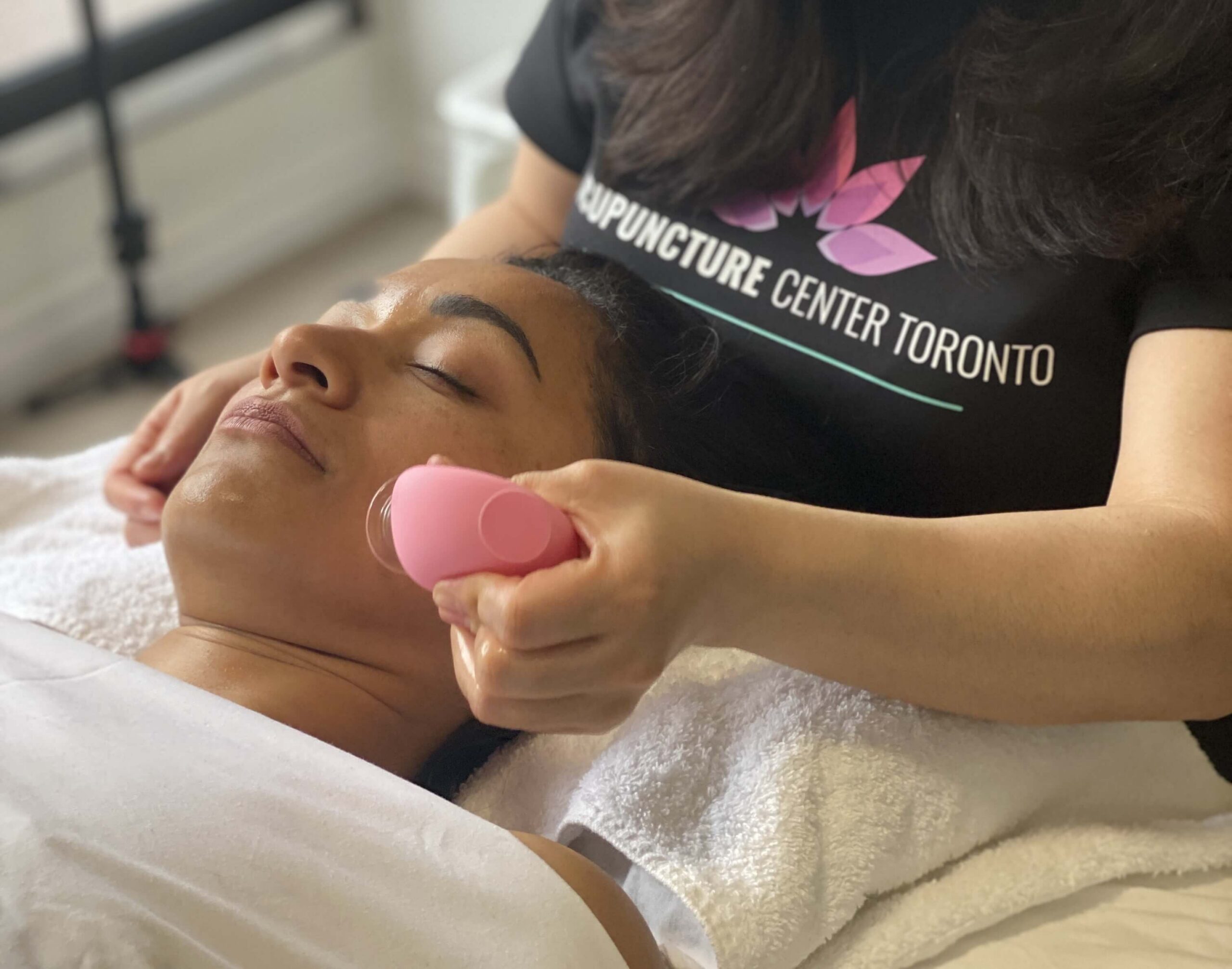 facial cupping anti aging in toronto at Acupuncture Center Toronto